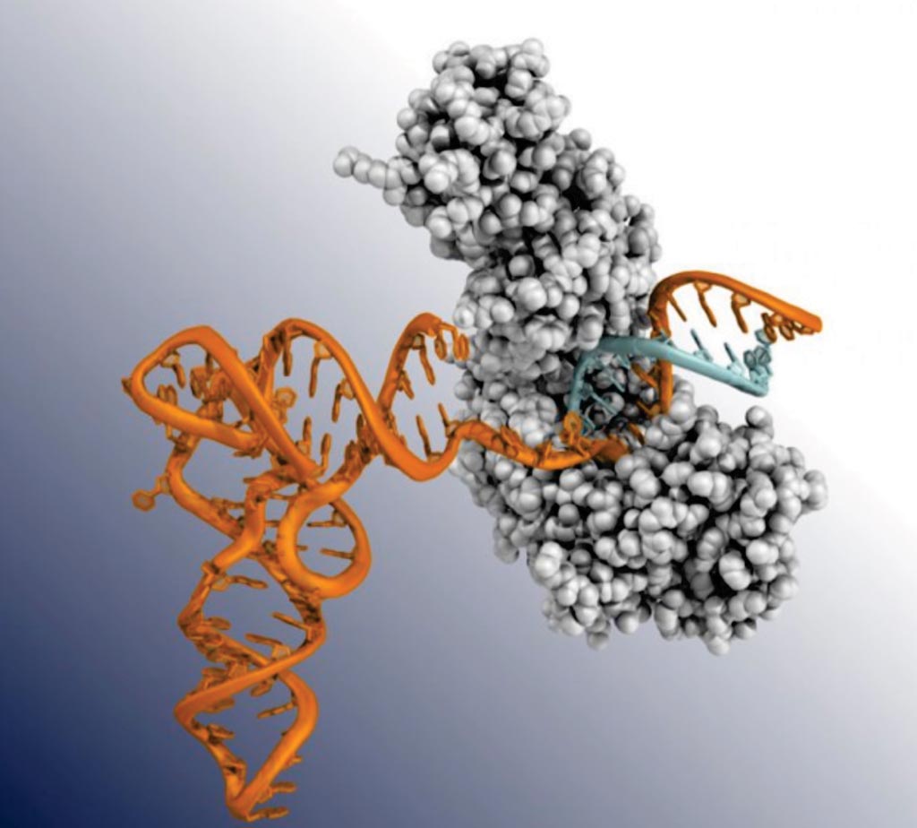 Image: An ancient bacterial enzyme (grey) crawls along a tangled strand of RNA (orange), creating a complimentary strand of DNA (blue). This enzyme, called GsI-IIC RT, and part of a group of enzymes known as TGIRTs, have novel properties that make it easier to detect RNA biomarkers from cancer and other disorders (Photo courtesy of the University of Texas at Austin).