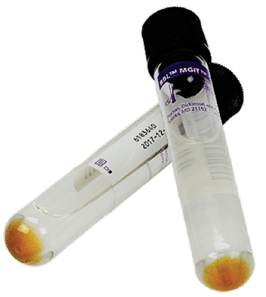 Image: The BACTEC mycobacterial growth indicator tubes (Photo courtesy of Becton, Dickinson and Company).