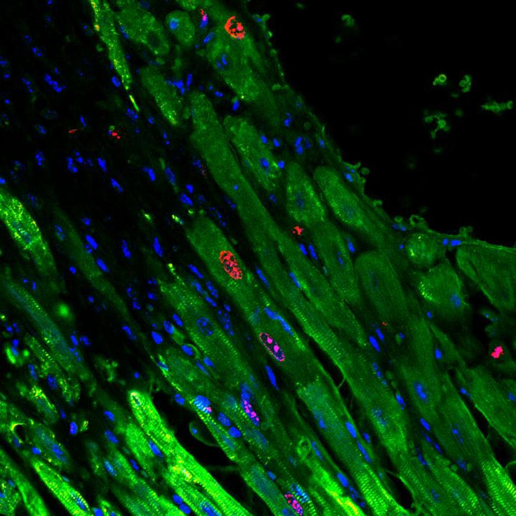 Image: A photomicrograph of green-stained, proliferating cardiomyocytes in a mouse heart after gel injection (Photo courtesy of the University of Pennsylvania).
