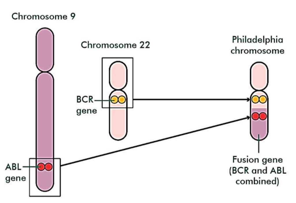 Image: On the left side of the diagram, the ABL gene from Chromosome 9 and the BCR gene from Chromosome 22 are combined together to make the ‘Philadelphia chromosome’. This chromosome has a small part at the top and a longer part of the bottom. The bottom part is labelled as a fusion gene, which is BCR and ABL combined (Photo courtesy of Macmillan Cancer Support).