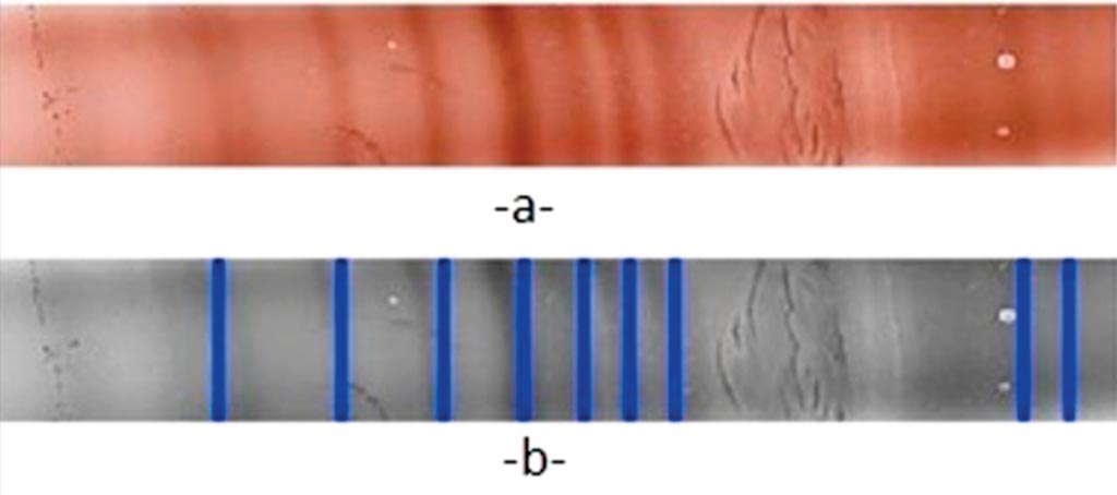 Image: Isoelectric focusing on agarose gel for immunoglobulins: a) Original scanned color image, b) gray scale image (Photo courtesy of the Catholic University of Lille).