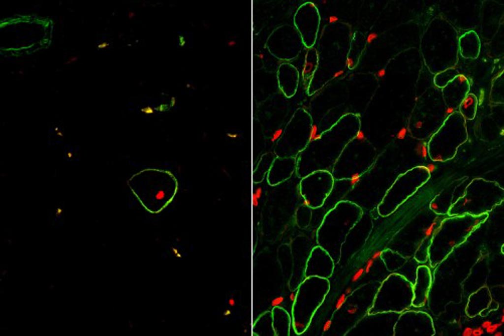 Image: Skeletal muscle cells isolated using the ERBB3 and NGFR surface markers (right) restore human dystrophin (green) after transplantation significantly greater than previous methods (left) (Photo courtesy of the University of California, Los Angeles and Nature Cell Biology).