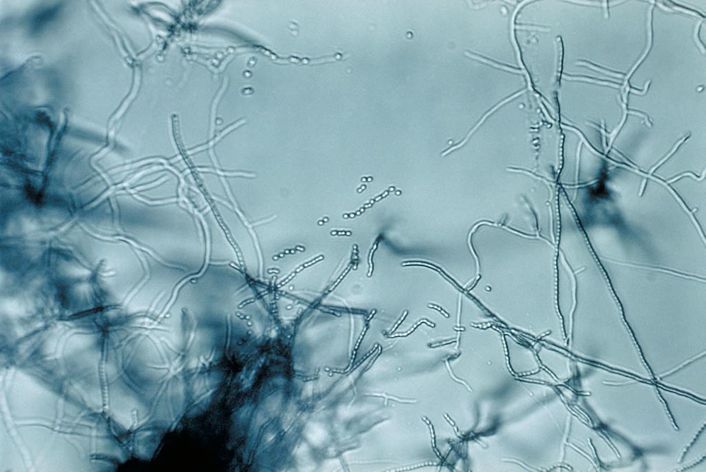 Image: A slide culture of a Streptomyces species (Photo courtesy of Wikimedia Commons).