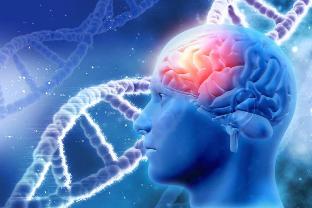 Image: Researchers have identified genes that could be precursors to Alzheimer’s disease, which could be targets for new treatments that may delay or prevent the onset of the disease (Photo courtesy of Medical News Today).