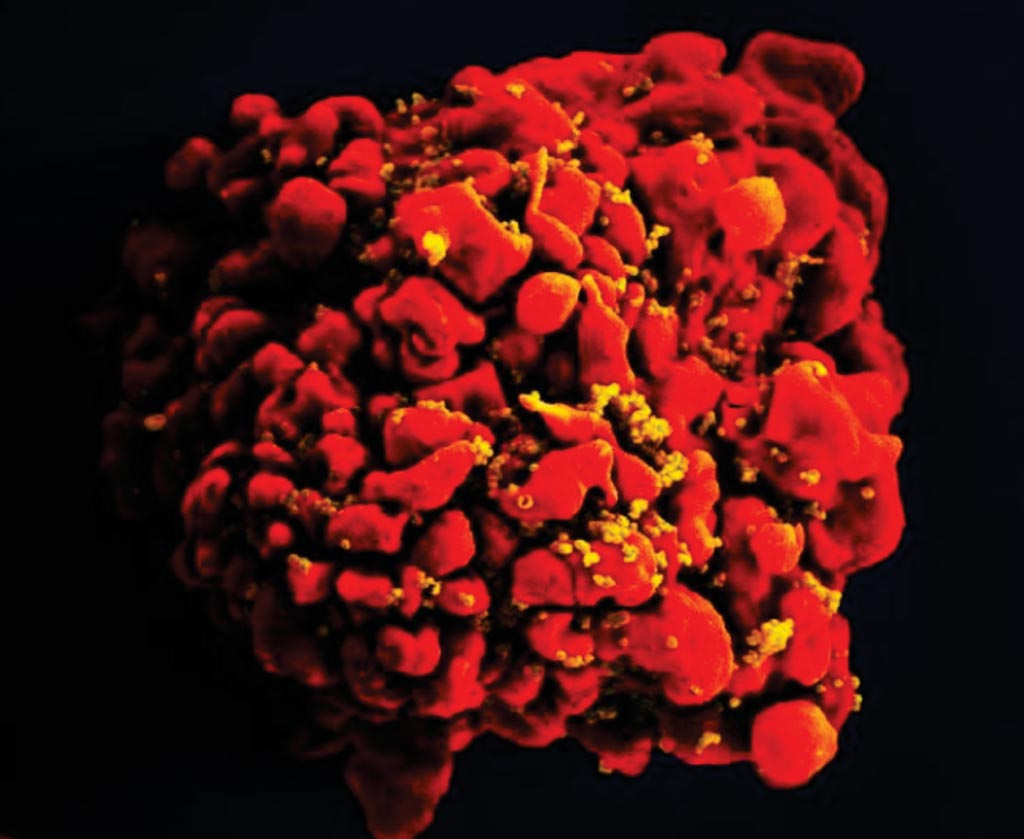 Image: A digitally colorized scanning electron microscopic (SEM) photograph depicting a single, red-colored H9-T-cell that had been infected by numerous, spheroid-shaped, mustard-colored human immunodeficiency virus (HIV) particles, which can be seen attached to the cell\'s surface membrane (Photo courtesy of the US National Institute of Allergy and Infectious Diseases).