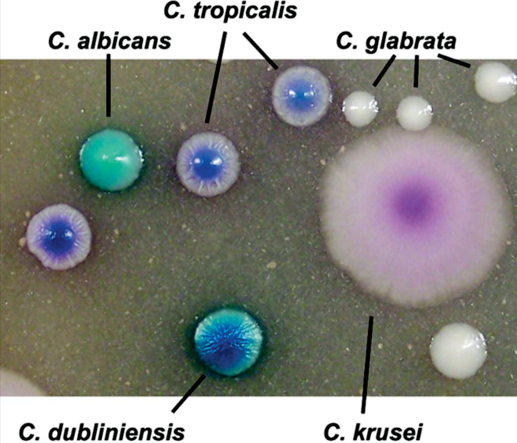 Image: Colonies of different species of Candida after growing for 48 hours at 37 °C in CHROMagar Candida medium supplemented with Pal\'s agar (Photo courtesy of the American Society of Microbiology).