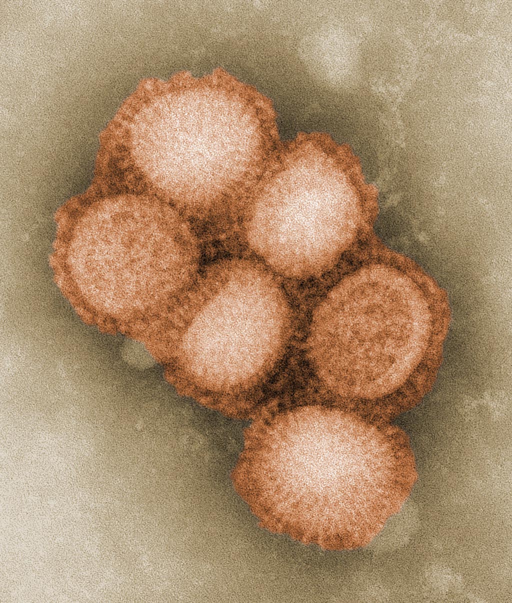 Image: A colorized negative stained transmission electron micrograph (TEM) depicting flu virus ultrastructural morphology (Photo courtesy of the CDC).