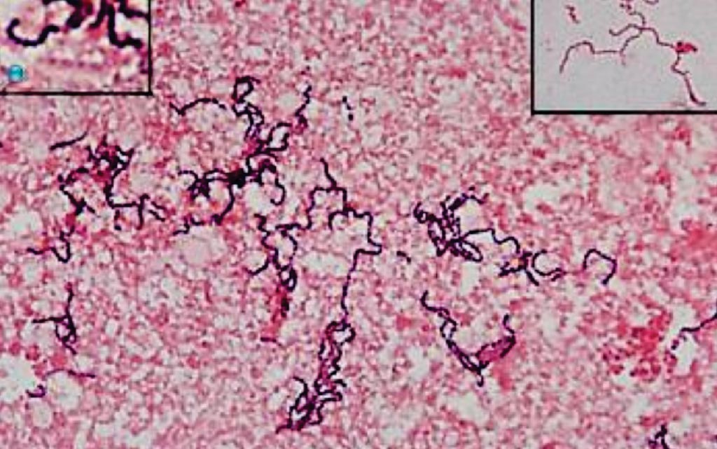 Image: Parvimonas, gram-positive cocci, when found in the vagina increase the risk of HIV (Photo courtesy of Erasmus Medical Center).