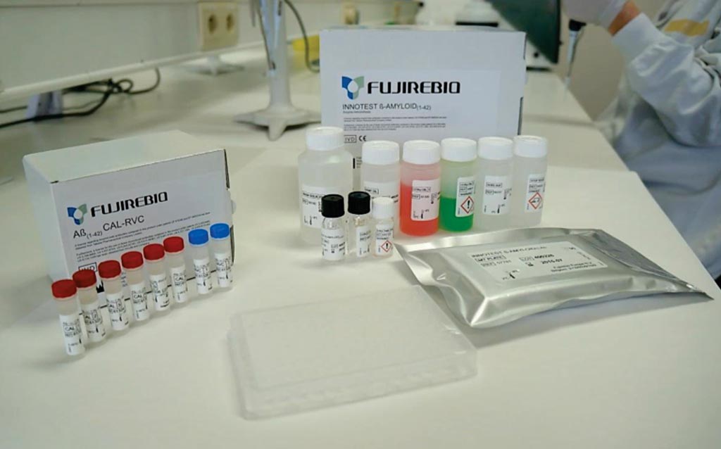 INNOTEST β-AMYLOID(1-42) представляет собой твердофазный иммуноферментный анализ для количественного определения β-амилоида (1-42) в цереброспинальной жидкости человека (ЦСЖ). Фото любезно предоставлено Fujirebio Diagnostics. INNOTEST β-AMYLOID(1-42) представляет собой твердофазный иммуноферментный анализ для количественного определения β-амилоида (1-42) в цереброспинальной жидкости человека (ЦСЖ). Фото любезно предоставлено Fujirebio Diagnostics.