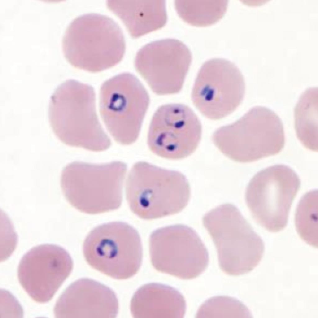 Image: Rings of Plasmodium falciparum in a stained thin blood smear (Photo courtesy of the CDC).