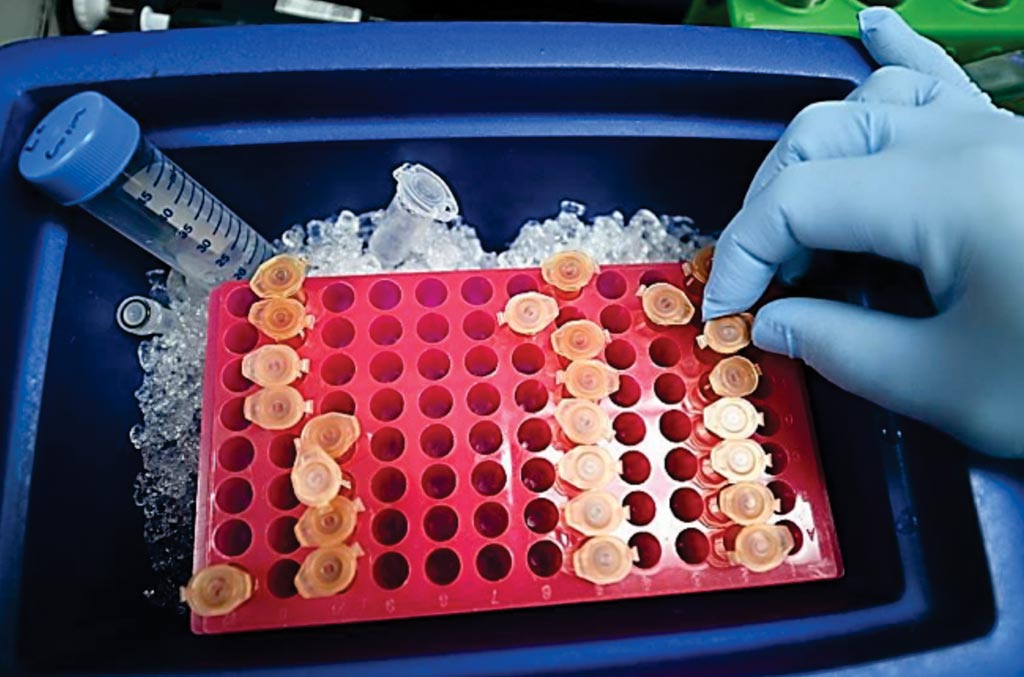 Image: Blood samples used to assess traumatic brain injury using the Brain Trauma Indicator test (Photo courtesy of Banyan Biomarkers).