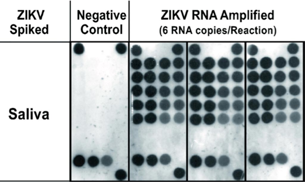 Image: Detection in saliva of Zika virus using reverse-transcription LAMP coupled with reverse dot blot analysis (Photo courtesy of New York University College of Dentistry).