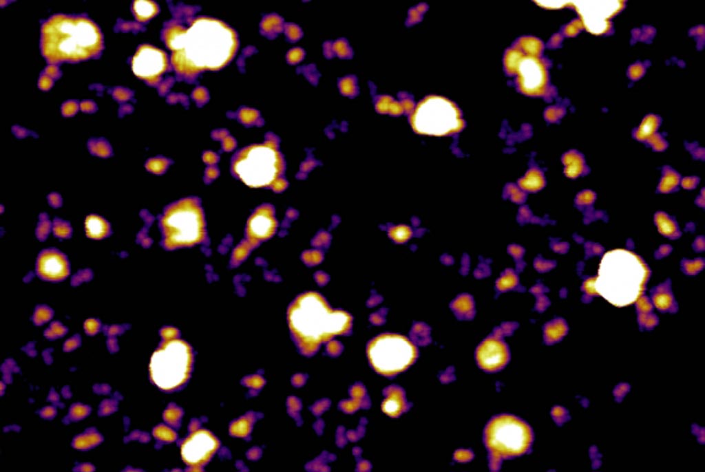 Image: Atomic force microscopy image of exosomes (white ball-like structures) and exomeres (purple and yellow) secreted by melanoma tumor cells (Photo courtesy of Molecular Cytology Core Facility, Memorial Sloan Kettering Cancer Center).