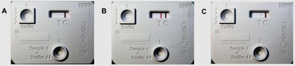 Image: Representative non-reactive (A), strongly reactive (B) and weakly reactive (C) Dual Path Platform (DPP) assay results for leptospirosis (Photo courtesy of the Oswaldo Cruz Foundation).