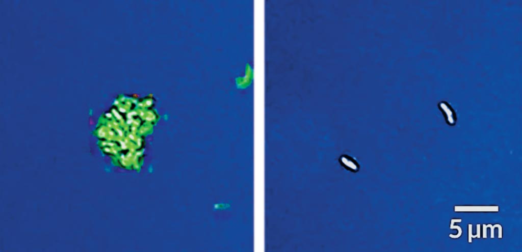 Image: A new technique that makes tuberculosis bacteria glow detects living Mycobacterium tuberculosis cells that have not been treated with drugs (left) but not those that have been treated (right) (Photo courtesy of Stanford University).