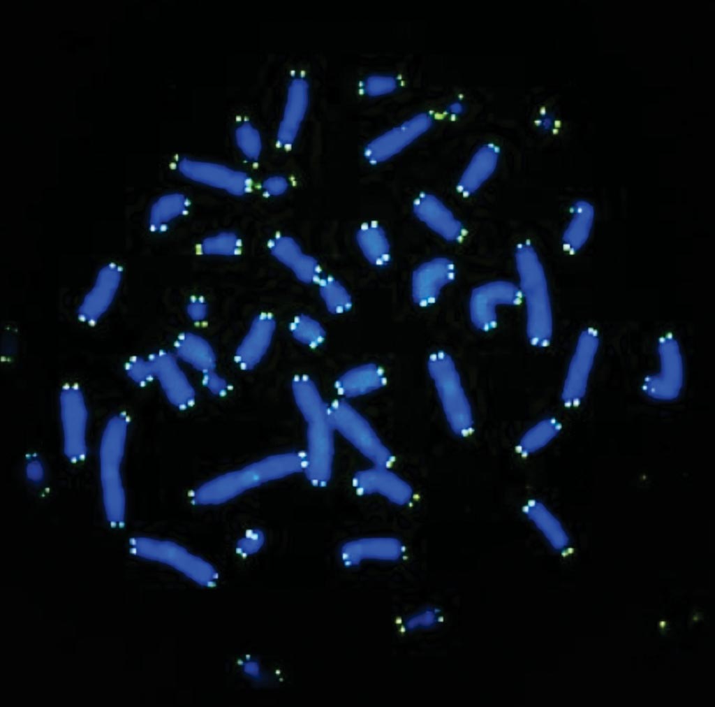 Image: Chromosomes with telomeres at their tips, in green. The intensity of the green signal is one indicator of telomere length, which is a measure of cellular “aging” and determines how many times a cell can divide (Photo courtesy of Professor George Daley, MD, PhD).