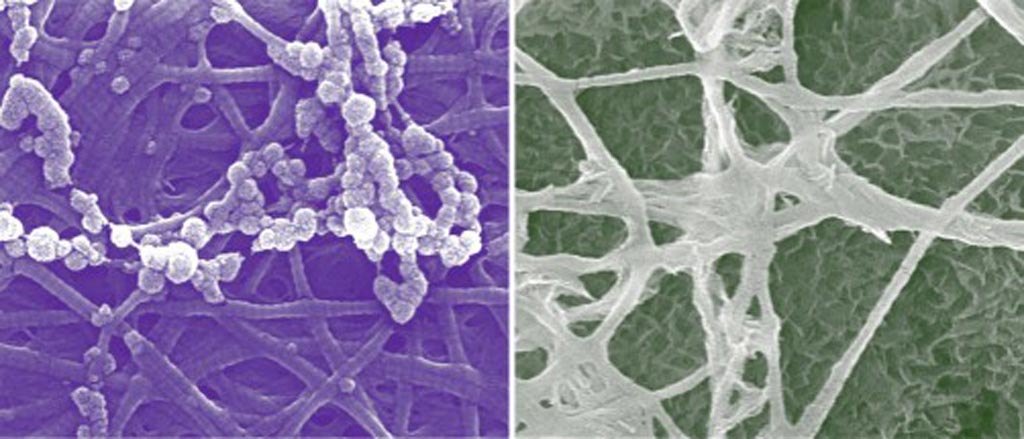 Image: Calcium phosphate mineralization occurs in both extra- and intrafibrillar spaces of collagen (left and right images, respectively). The confined collagen structure contributes to reducing the thermodynamic energy barrier to intrafibrillar nucleation for bone mineralization (Photo courtesy of Washington University).
