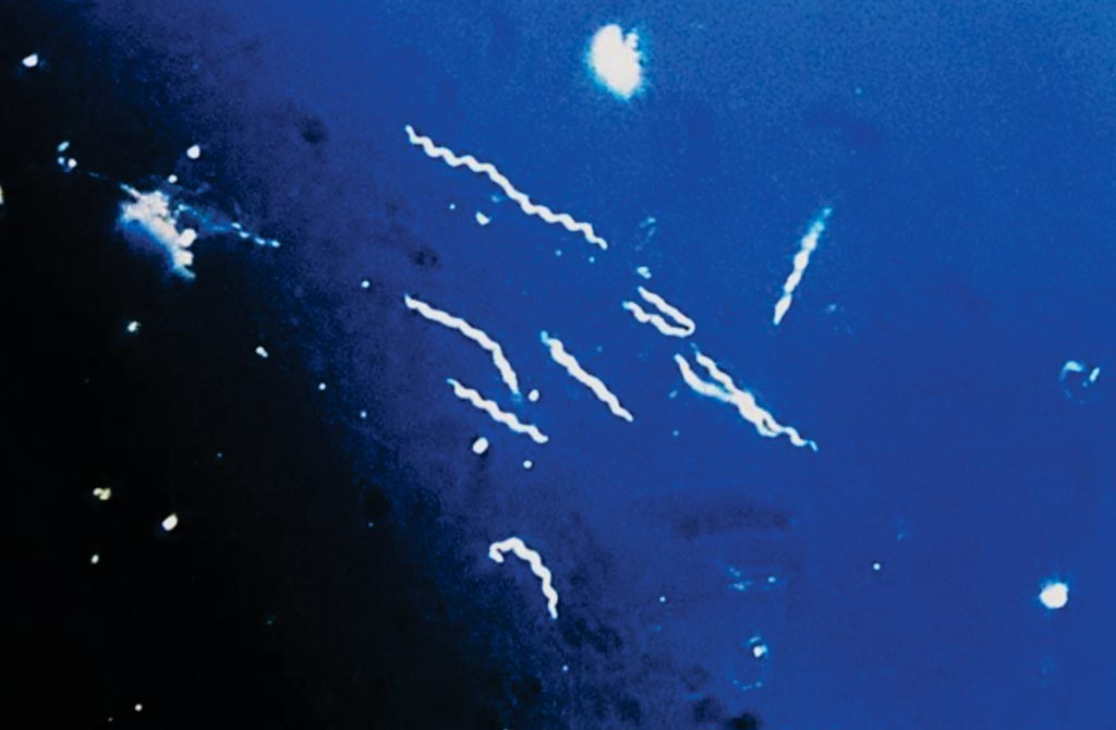 Image: Using darkfield microscopy technique, this photomicrograph, magnified ×400, reveals the presence of spirochete, or \"corkscrew-shaped\" bacteria known as Borrelia burgdorferi, which is the pathogen that causes Lyme disease (Photo courtesy of the CDC).