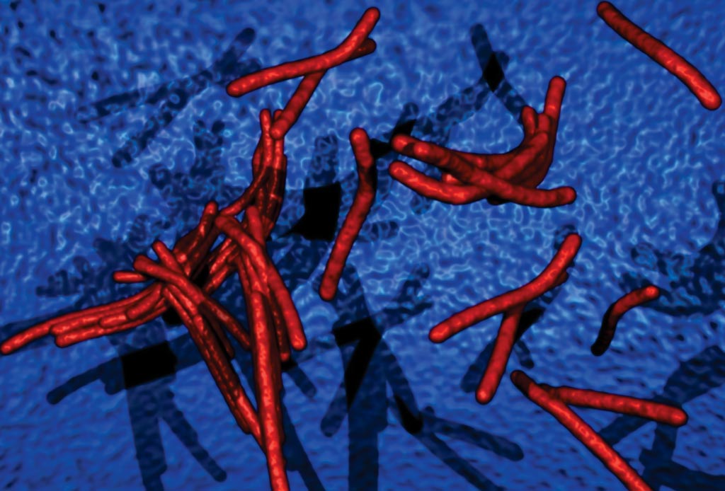 Image: Computer-generated illustration of Mycobacterium tuberculosis bacteria, Ziehl-Neelsen stain. Acid-fast bacilli stain red and the background is blue (Photo courtesy of Microbiology Pictures).