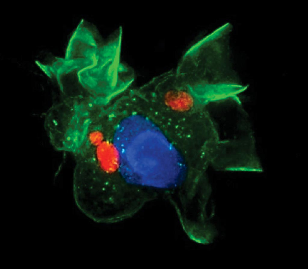 Микрофотография дендритной клетки (зеленая), зараженной Toxoplasma gondii (красная). Фото любезно предоставлено Институтом Веннера-Грена (Wenner-Gren Institute).