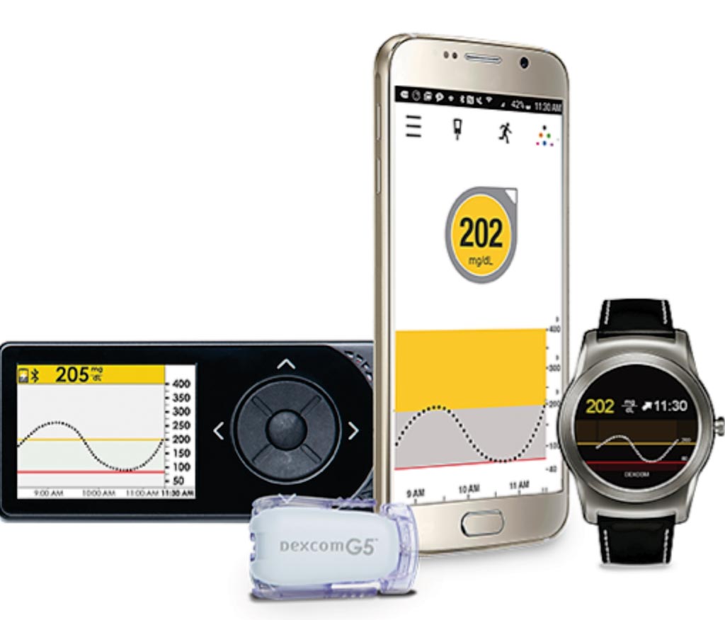Image: The G5 mobile continuous glucose monitoring (CGM) system (Photo courtesy of Dexcom).