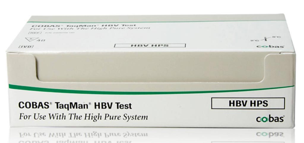 Image: The COBAS TaqMan HBV test (Photo courtesy of Roche Diagnostics).