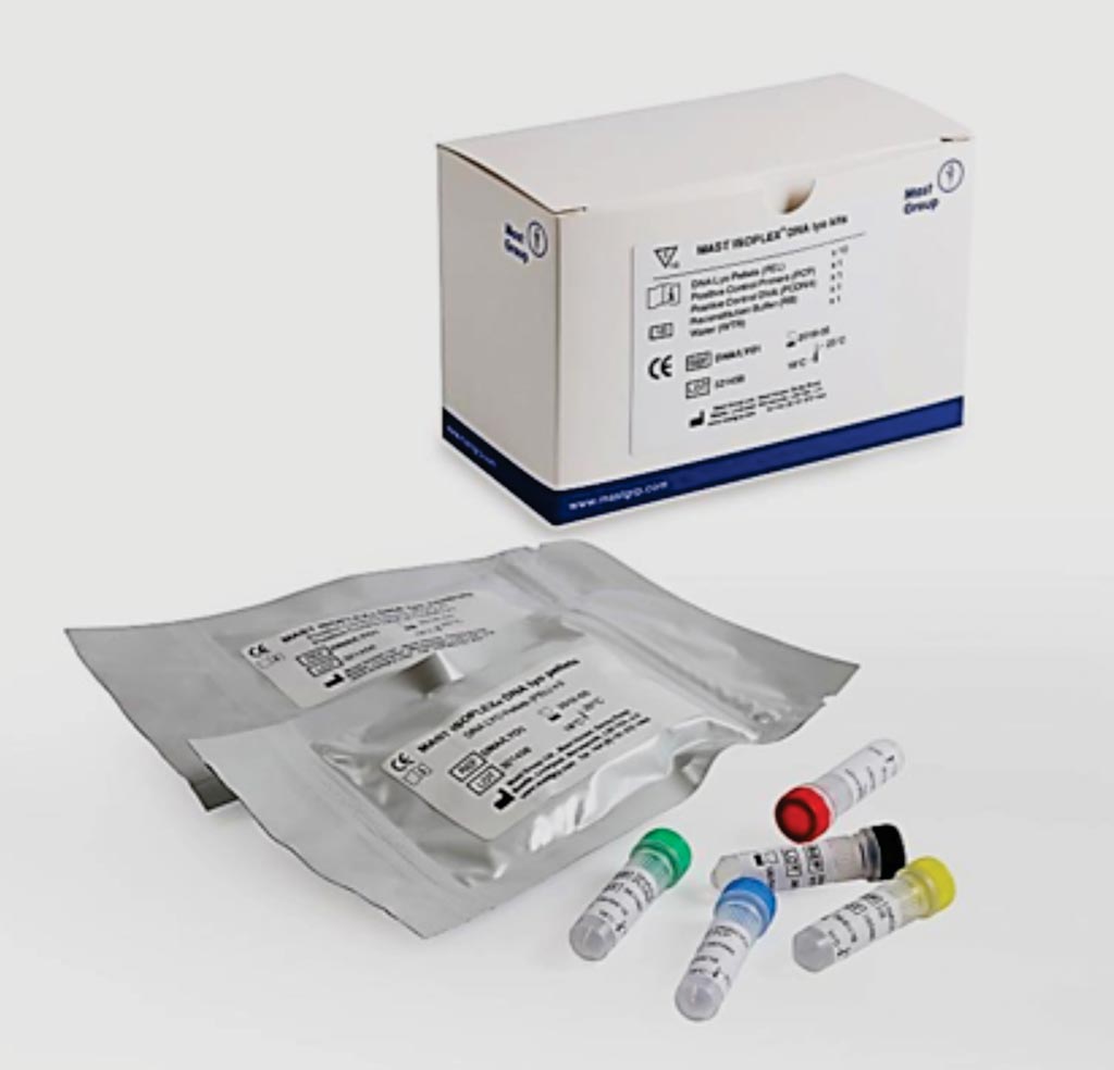 Image: The MAST ISOPLEX DNA kit is a ready to use amplification kit, making molecular diagnostics with LAMP easy and efficient (Photo courtesy of Mast Diagnostica).
