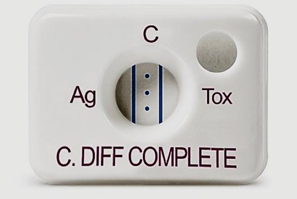 Image: A positive C. DIFF QUIK CHEK COMPLETE. The assay simultaneously tests for GDH and Toxins A & B providing actionable C. difficile results in less than 30 minutes (Photo courtesy of Alere).