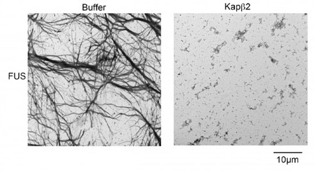 Image: Dense FUS protein fibrils form in the absence of nuclear-import receptors (NIRs, left), but are disrupted when NIRs are present (right) (Photo courtesy of Dr. James Shorter, University of Pennsylvania).