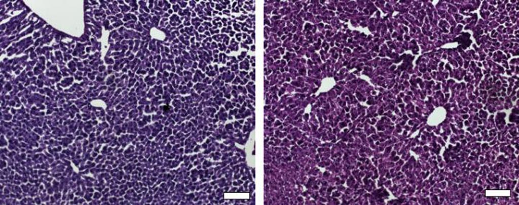 Image: Histological sections of liver from control mice treated with saline (left) and the CRISPR/Cas9 epigenetic repression system in which cholesterol levels were lowered (right) show generally normal and healthy tissue (Photo courtesy of Dr. Charles Gersbach, Duke University).