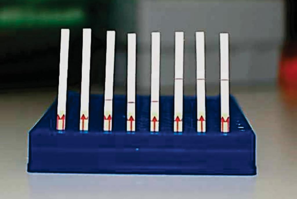 Image: A collection of SHERLOCK paper test strips: Unused paper strips (Left); Paper tests displaying a negative SHERLOCK readout (Middle); Paper tests displaying a positive SHERLOCK readout (Right) (Photo courtesy of Broad Institute of MIT and Harvard).