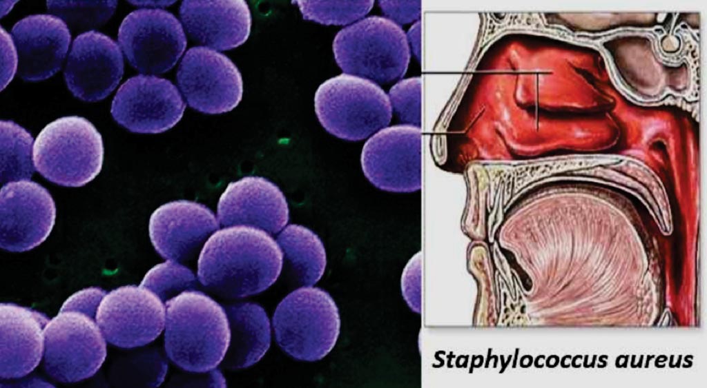 Image: The habitat and morphology of Staphylococcus aureus (Photo courtesy of Sagar Aryal).
