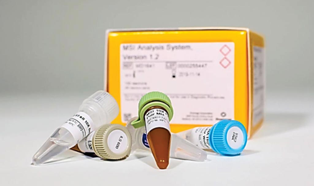 Image: The MSI Analysis System, Version 1.2, is a fluorescent multiplex PCR-based method to detect microsatellite instability (MSI), a form of genomic instability (Photo courtesy of Promega).