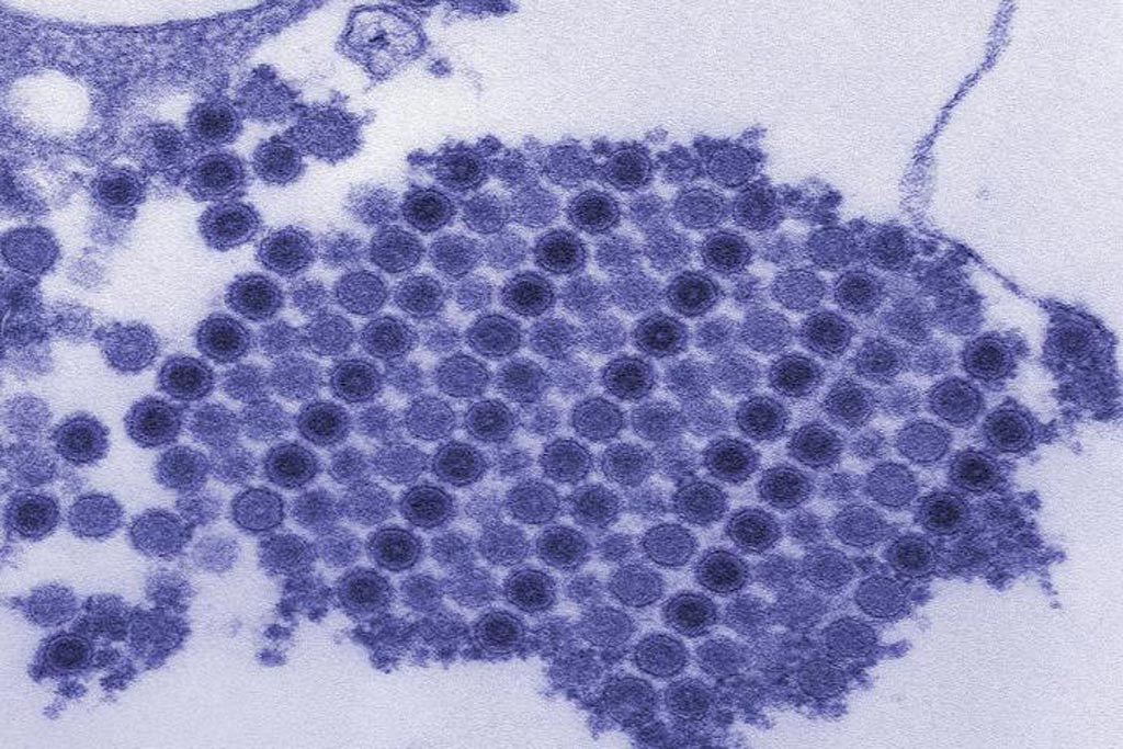 Image: A scanning electron micrograph (SEM) of chikungunya virus particles crystallized into a neat grid (Photo courtesy of the CDC / Cynthia Goldsmith).