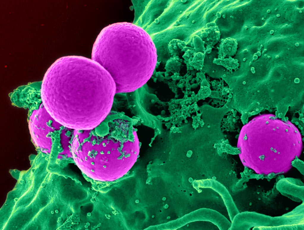 Image: A scanning electron micrograph (SEM) of a human neutrophil ingesting MRSA bacteria (Photo courtesy of the U.S. National Institute of Allergy and Infectious Diseases).