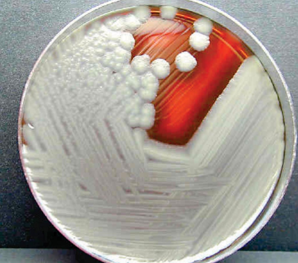 Image: Mycobacterium chimaera colonies growing on agar; the infections can cause serious injury, including pneumonia and death. Of particular concern is that patients infected with M. chimaera may not develop symptoms and signs of infection for months to years after initial exposure, making the infections difficult to detect and diagnose (Photo courtesy of the CDC).