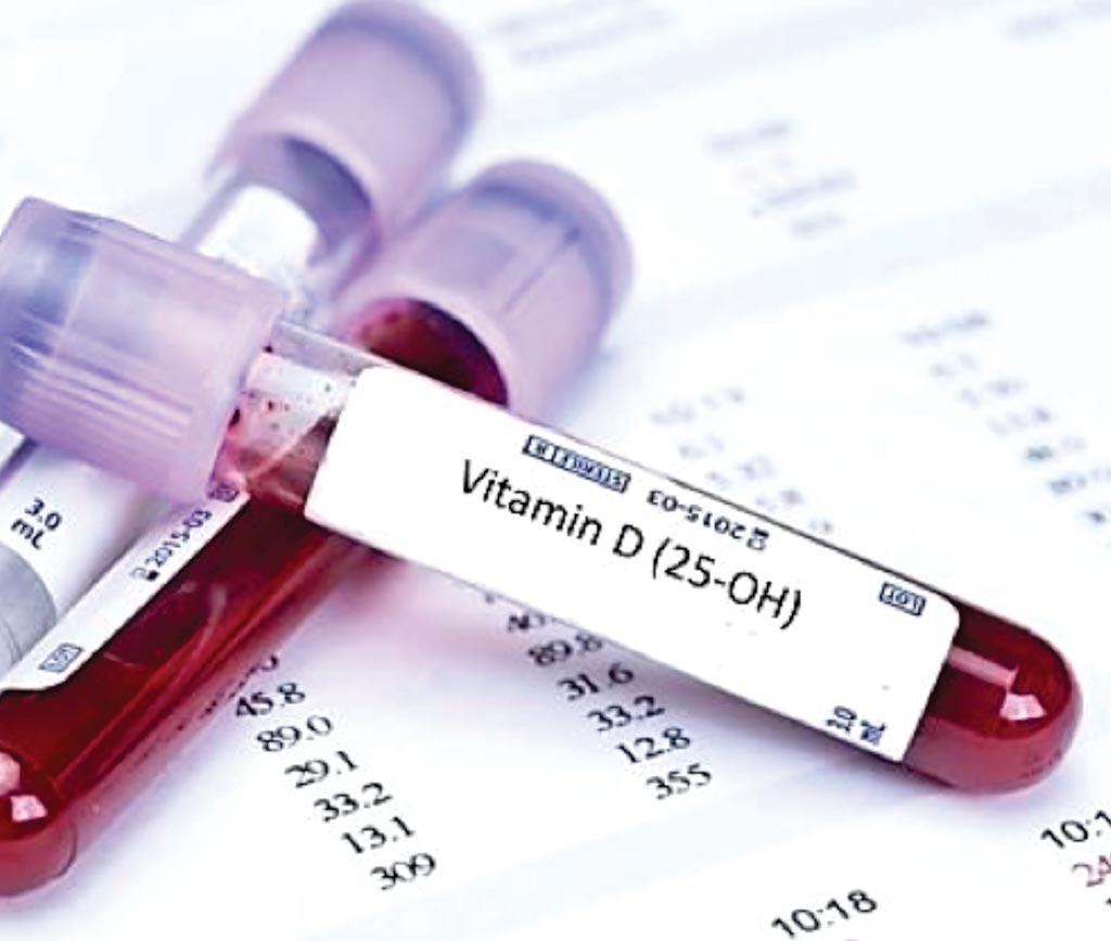 Image: A blood test for Vitamin D, where deficiency may indicate higher plasma lipid levels (Photo courtesy of bluehorizon).