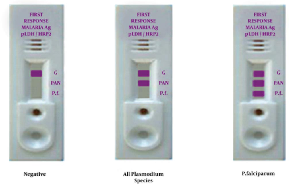 Image: Rapid diagnostic tests for malaria (Photo courtesy of the Mashhad University of Medical Sciences).