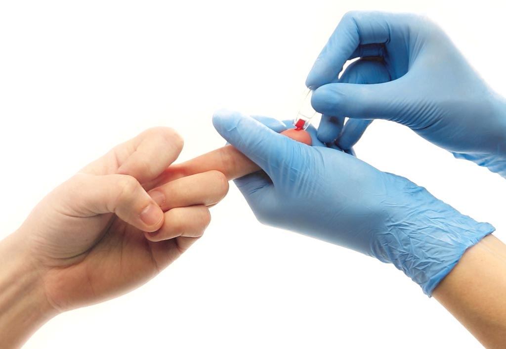 Image: The new educational guide provides a quick overview of capillary blood sampling best practice (Photo courtesy of EKF Diagnostics).