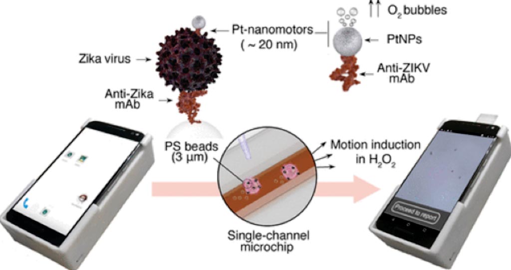 Image: Motion-based immunological detection of Zika virus using Platinum (Pt)-Nanomotors and a cell phone (Photo courtesy of Brigham and Women\'s Hospital).