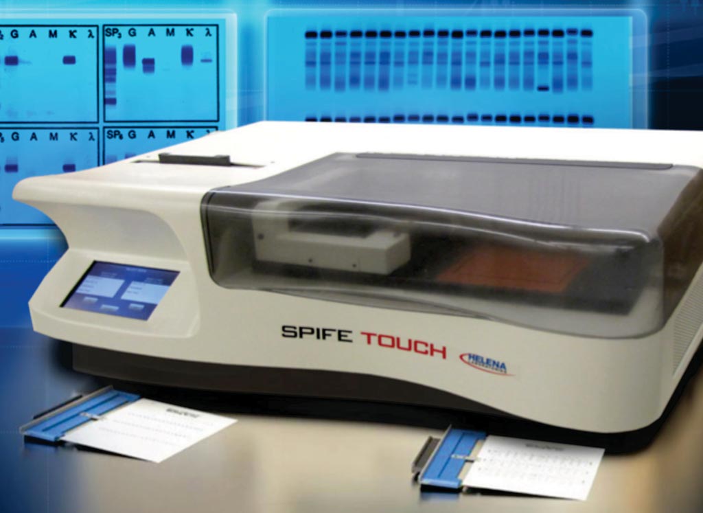 Image: The SPIFE Touch electrophoresis analyzer (Photo courtesy of Helena).
