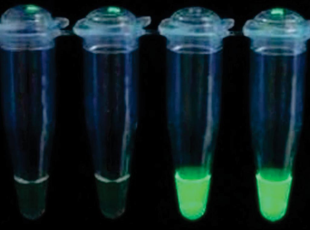 Image: The Loop Mediated Isothermal Amplification (LAMP) test for the detection of malaria under ultra-violet light, positives two right tubes (Photo courtesy of HUMAN Diagnostics).