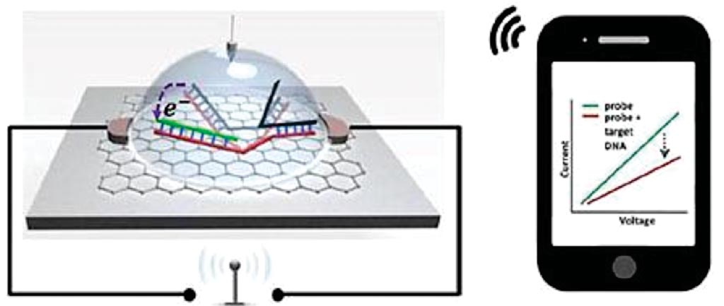 Image: An illustration of graphene-based single nucleotide polymorphism (SNP) detection chip wirelessly transmitting signal to a smartphone (Photo courtesy of Professor Ratnesh Lal, PhD).
