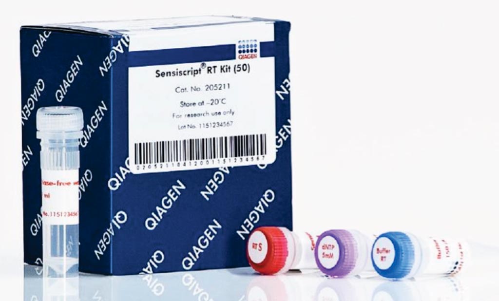 Image: The Sensiscript reverse transcription kit is ideally suited for highly sensitive applications using very small amounts of RNA (Photo courtesy of Qiagen).