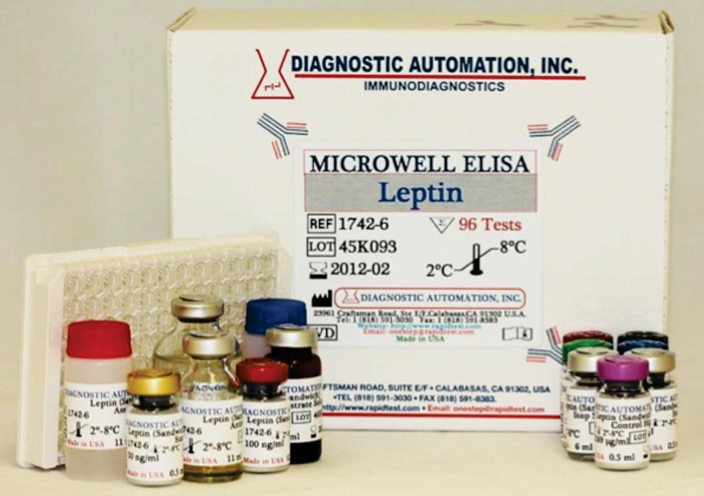 Image: An ELISA for quantitative determination of leptin in human serum and plasma (Photo courtesy of Diagnostic Automation).