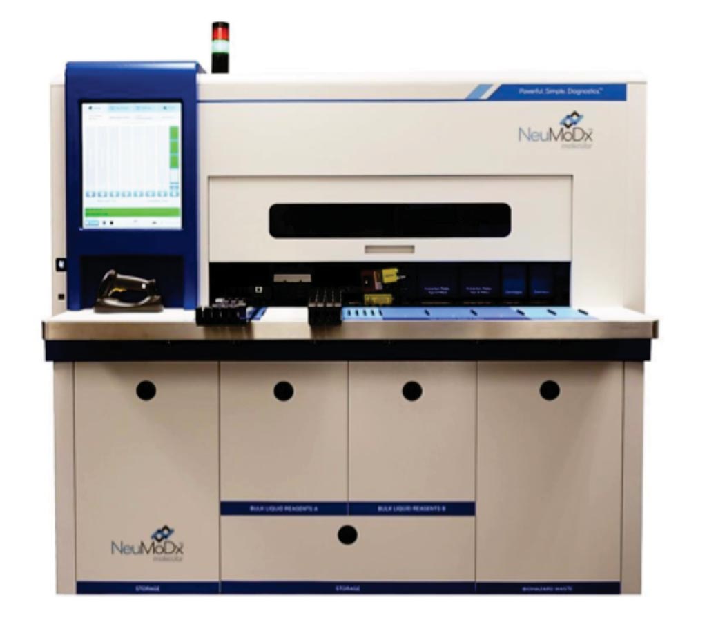 Image: The NeuMoDx GBS assay is run on the 288 molecular system (Photo courtesy of NeuMoDx Molecular).