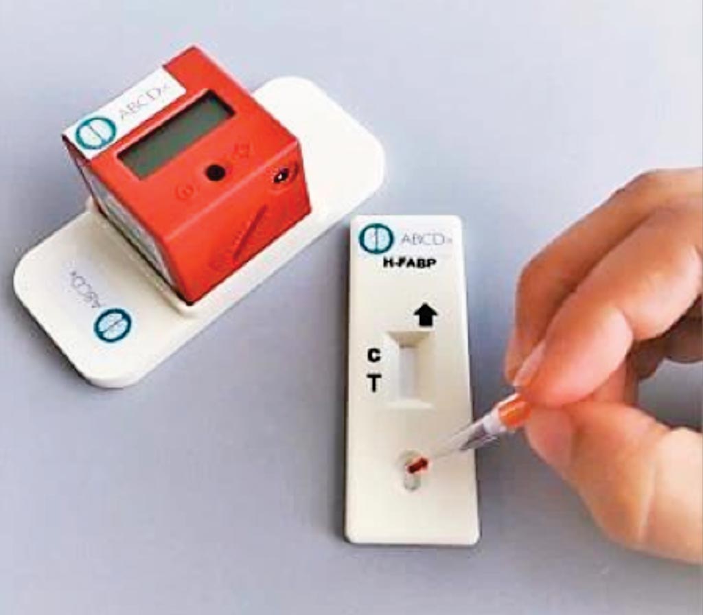 Image: One drop of blood is enough for TBIcheck to diagnose a possible mild brain trauma. If a line appears below the control line, the injured person will have to go to the hospital for a CT scan (Photo courtesy of the University of Geneva).