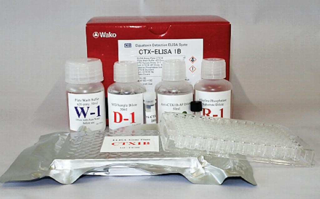 Image: A C-telopeptide of type 1 collagen (CTX) assay kit (Photo courtesy of Wako Chemicals).