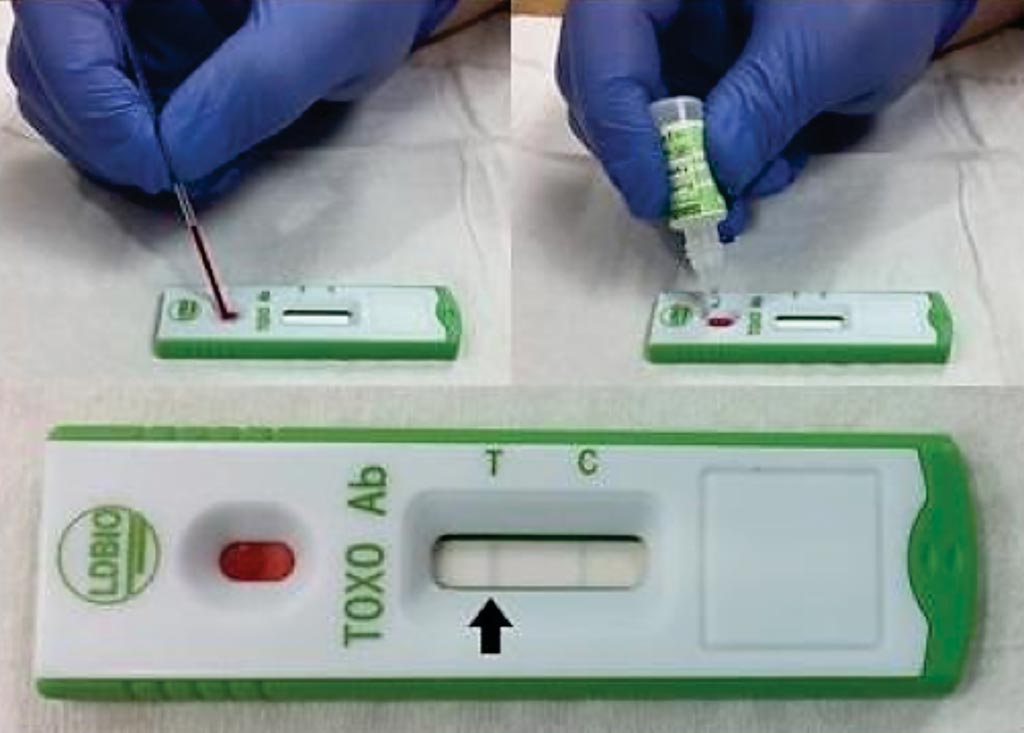 Image: The LDBIO test relies on an immunochromatographic lateral-flow assay. This system is designed to detect the presence (or absence) of IgG and IgM antibodies, indicative of Toxoplasma infection (Photo courtesy of the University of Chicago).