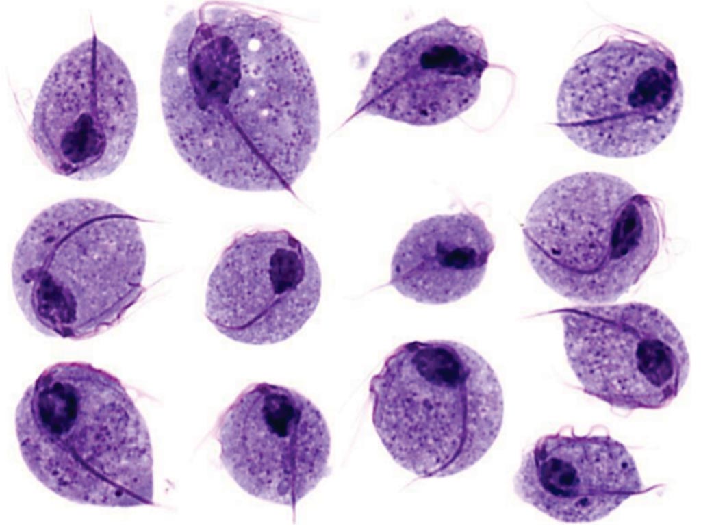 Trichomonas In Urine